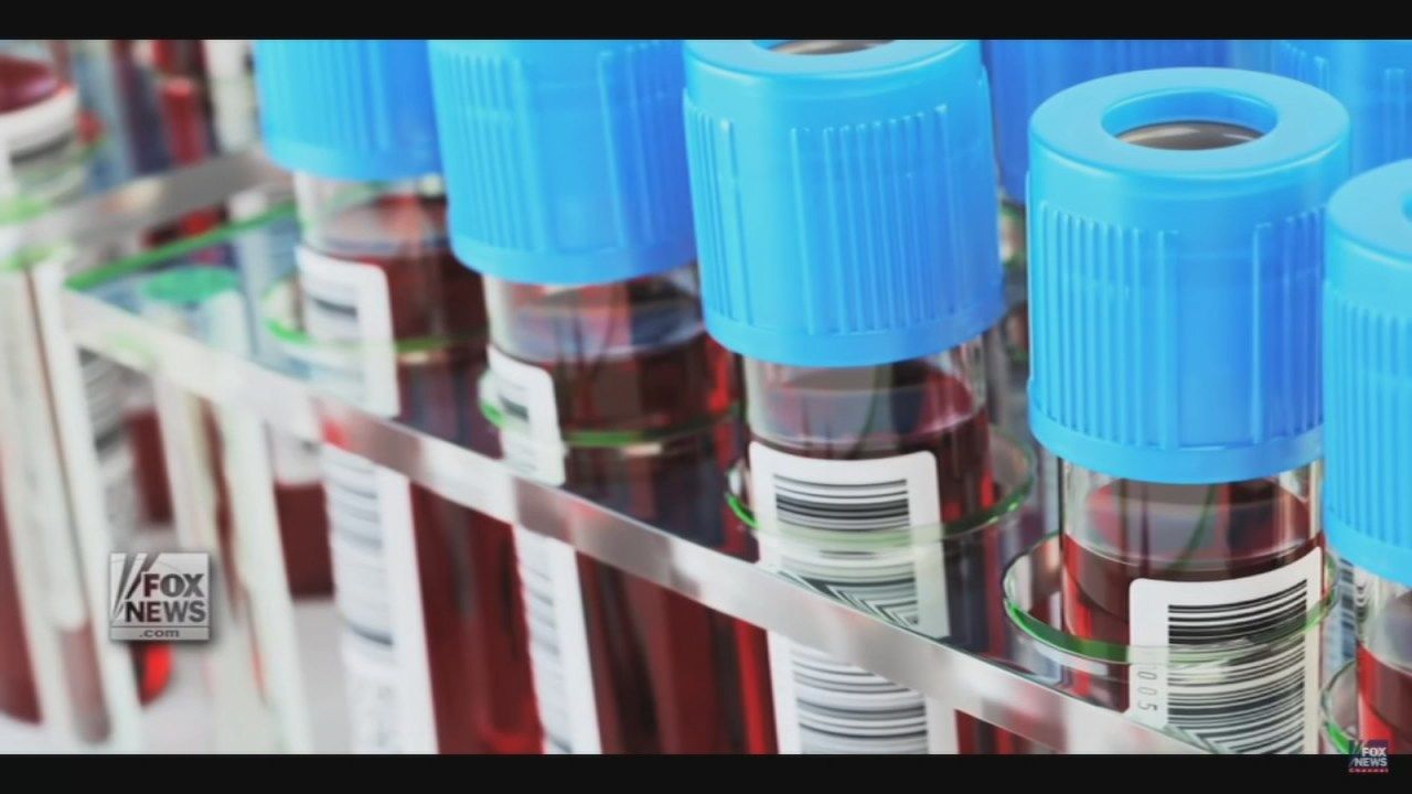 A former employee of a restaurant in St. Matthews has been diagnosed with acute hepatitis A, according to a news release from the Louisville Metro Department of Public Health and Wellness.