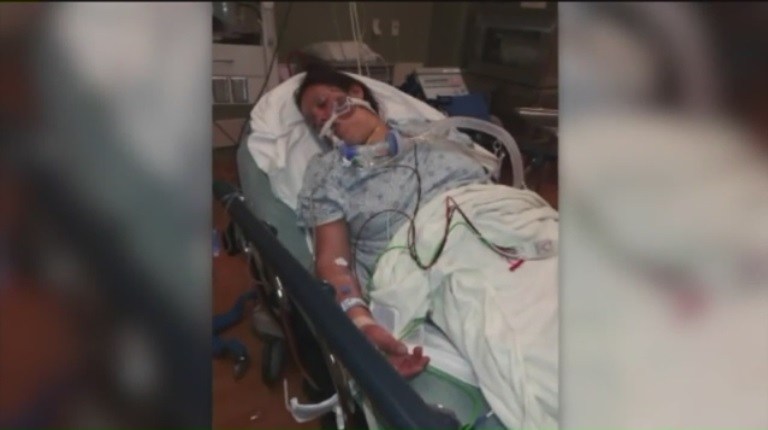 California woman in ICU with botulism after eating nacho cheese from a ...